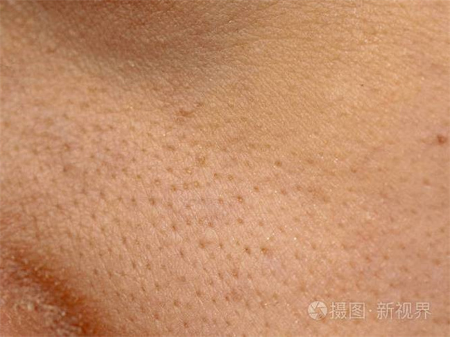 男人最受不了女朋友的5种肌肤问题_男生最怕的5种肌肤类型