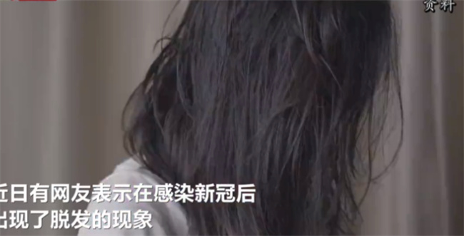 新冠会不会造成永久性脱发？_扎心了!感染新冠,还会脱发?