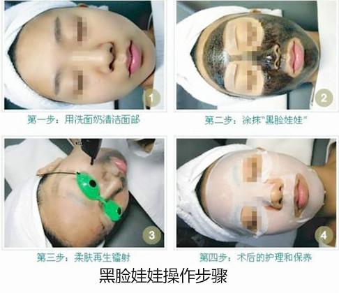 黑脸娃娃美白效果怎么样？使用后有什么注意事项吗