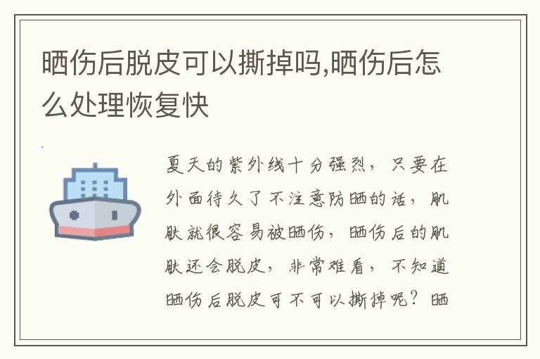晒伤后脱皮可以撕掉吗,晒伤后怎么