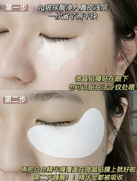 听小骨头微针眼膜怎么样？品牌在哪里？ 玻尿酸微晶贴使用效果