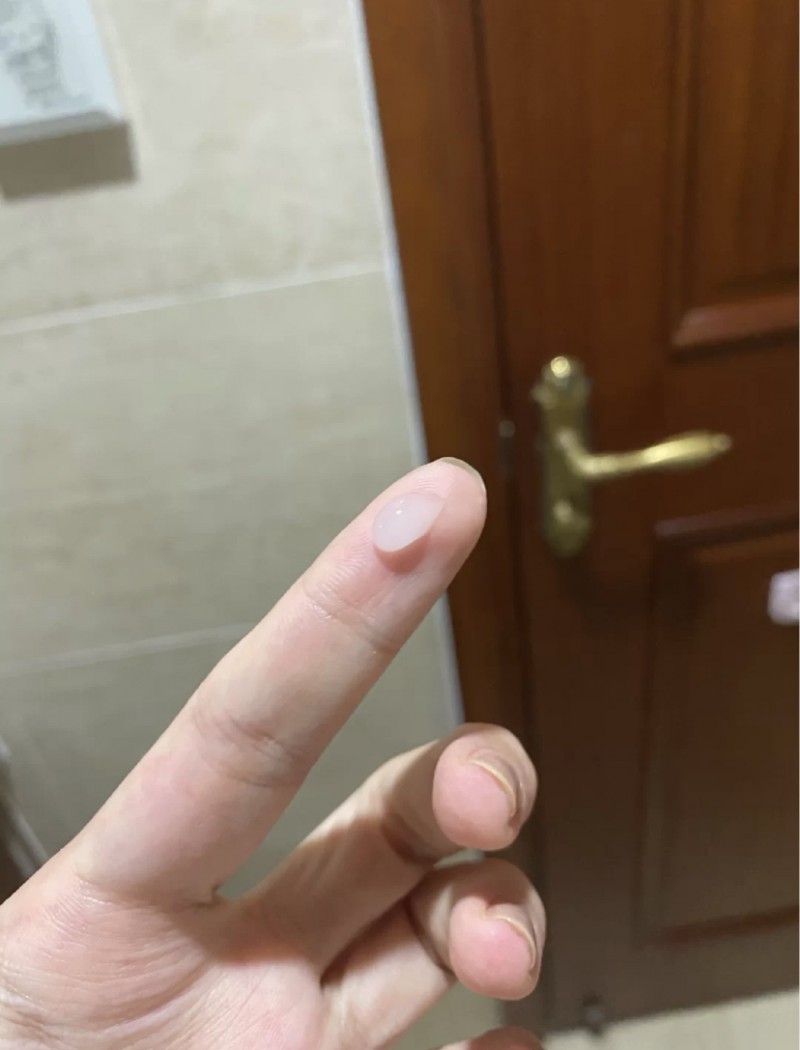 仁和眼霜真的好用吗？效果如何？使用一个月的抗皱淡化黑眼圈