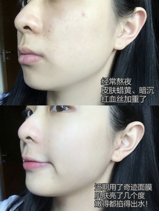 摇滚动物园电解质奇迹面膜怎么样？ 测量补水保湿效果